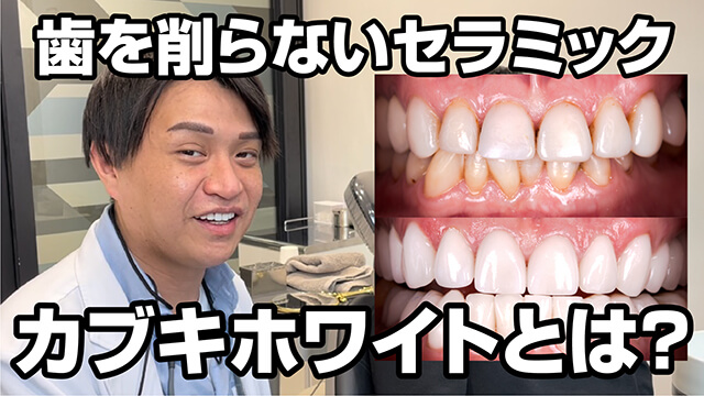 セラミック治療（削らないカブキホワイト）｜SK新宿歌舞伎町美容外科・歯科